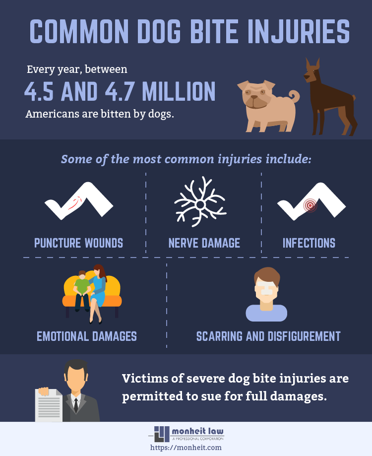 Common Dog Bite Injuries 01