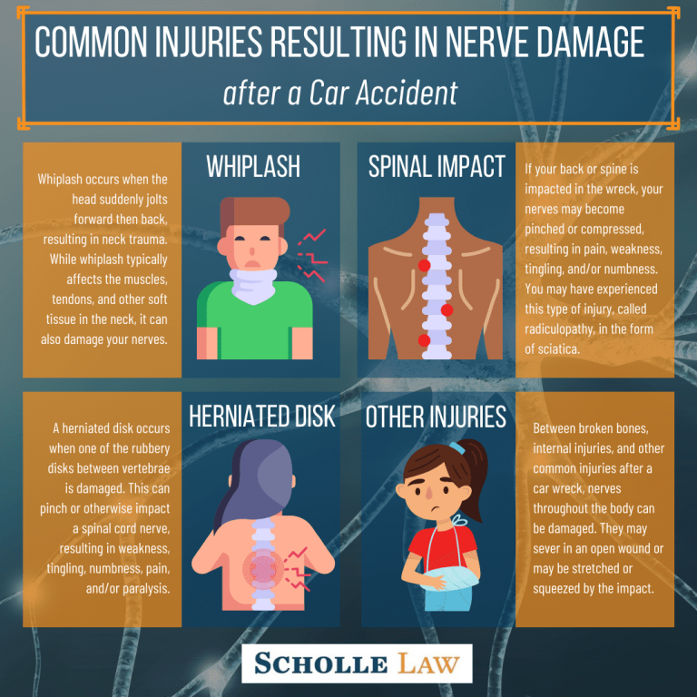 Can A Car Accident Cause A Pinched Nerve?