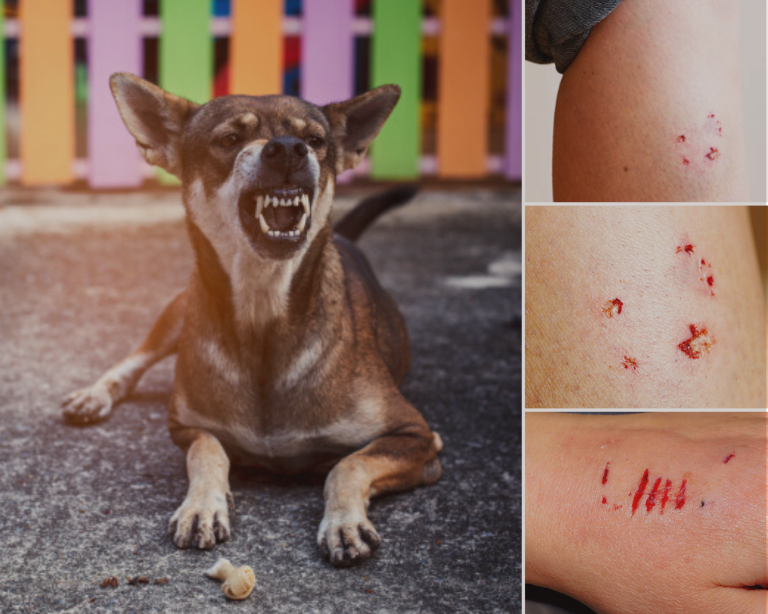 What Happens If Your Dog Bites Someone In Connecticut?