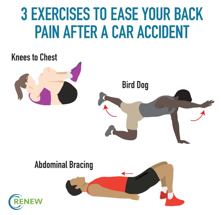 Can I Work Out After A Car Accident?