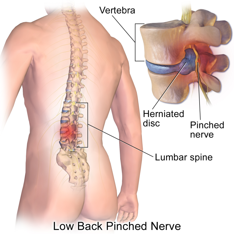 Why Does My Lower Back Hurt After A Car Accident?