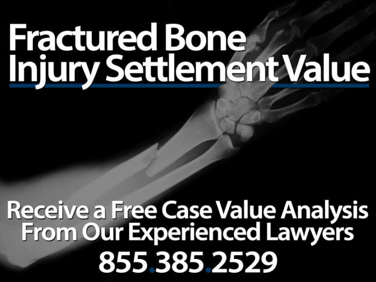 fractured bone case banner 768x576 1