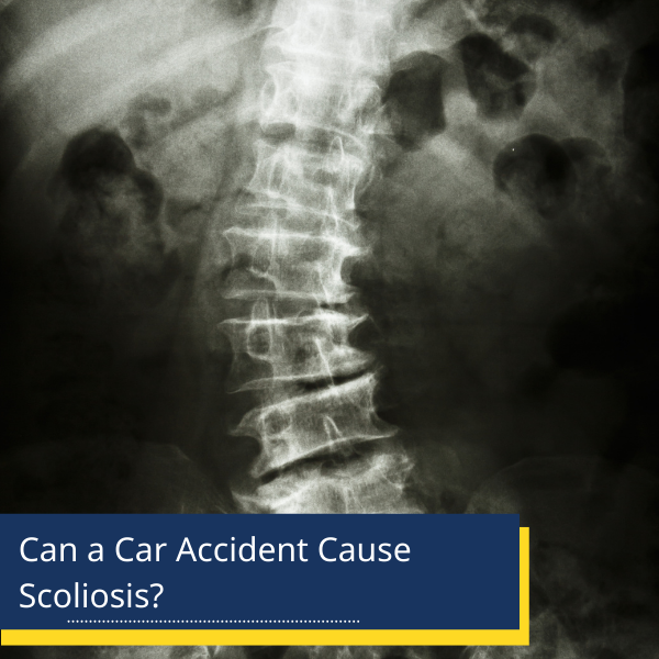 scoliosis